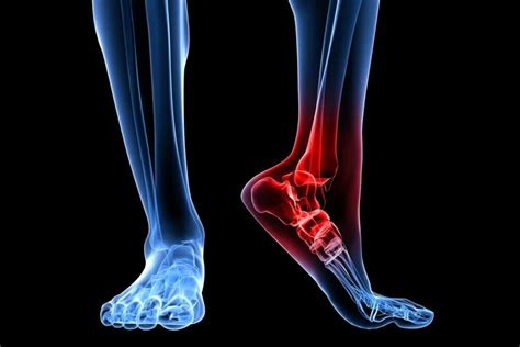 tri county foot & ankle center|Tri County Foot & Ankle Center.